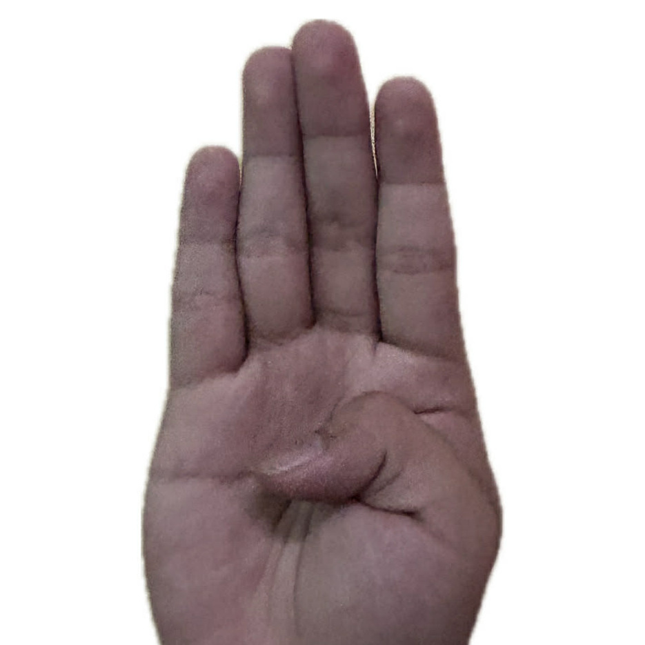 ASL Letter B